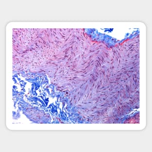 Peripheral nerve, light micrograph (C022/7315) Sticker